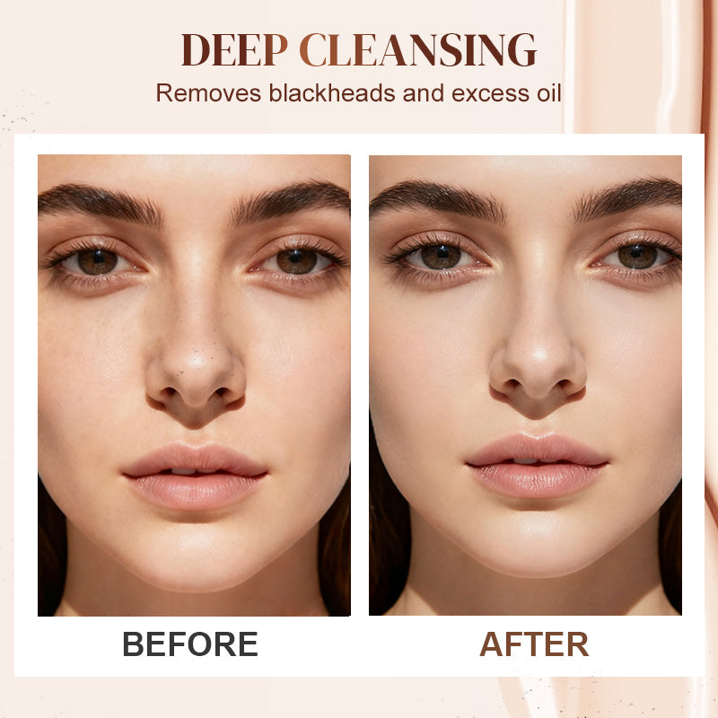 Aloe Vera Blackhead Remover Gel