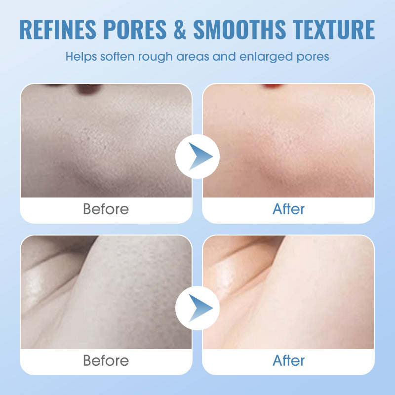🔥Last day of the limited-time 50% off sale!💕Gentle Deep Cleansing Exfoliating Gel